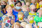 Haut-Katanga : la discrimination, les albinos déposent une mouture d’édit   