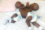 Kinshasa : les bébés siamois évacués de Kwilu sont décédés