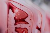 Des microplastiques retrouvés dans du sang humain pour la première fois