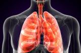 Ituri : 90 cas suspects de peste pulmonaire, dont 12 morts en 2021