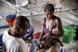 L’épidémie de rougeole déclarée dans la ville de Kinshasa