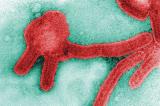 Premiers cas confirmés du virus de Marburg au Ghana