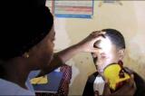 Épidémie de conjonctivite virale : les prisons de Beni et Butembo de plus en plus vulnérables