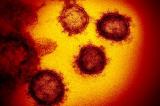Matadi : « le chinois arrivé à DIHAO n’a pas le Coronavirus »