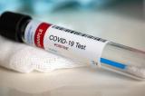 Congo/Brazza : le dépistage du coronavirus suspendu faute d'intrants