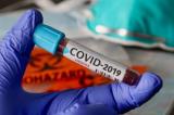 Bulletin épidémiologique du covid-19 : 156 nouveaux cas confirmés dont 4 nouveaux décès