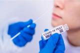 Covid-19 : la salive plus efficace que les tests nasopharyngés ?