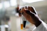 Covid-19 : l’OMS et les CDC Afrique appuient la recherche de thérapies de médecine traditionnelle en Afrique 