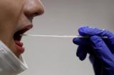 Covid-19 : un test salivaire “made in France” prouve son efficacité en “conditions réelles”