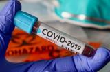Covid-19 : 32 nouveaux cas, 19 guéris et 1 décès en RDC (bulletin épidémiologique)